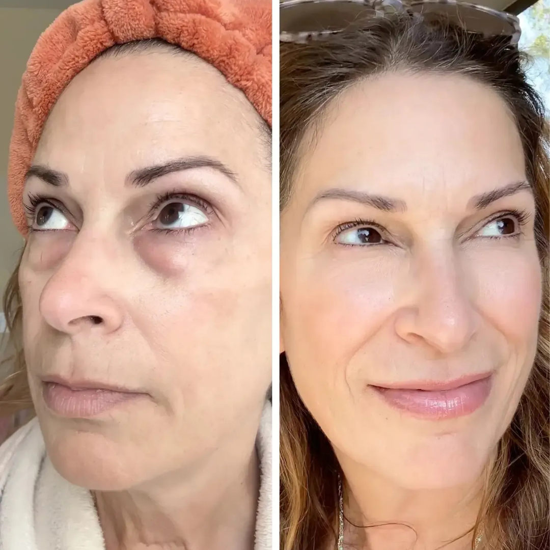 SKNDAILY™ - ALL IN ONE BALM FOR UNDER EYE RENEWAL