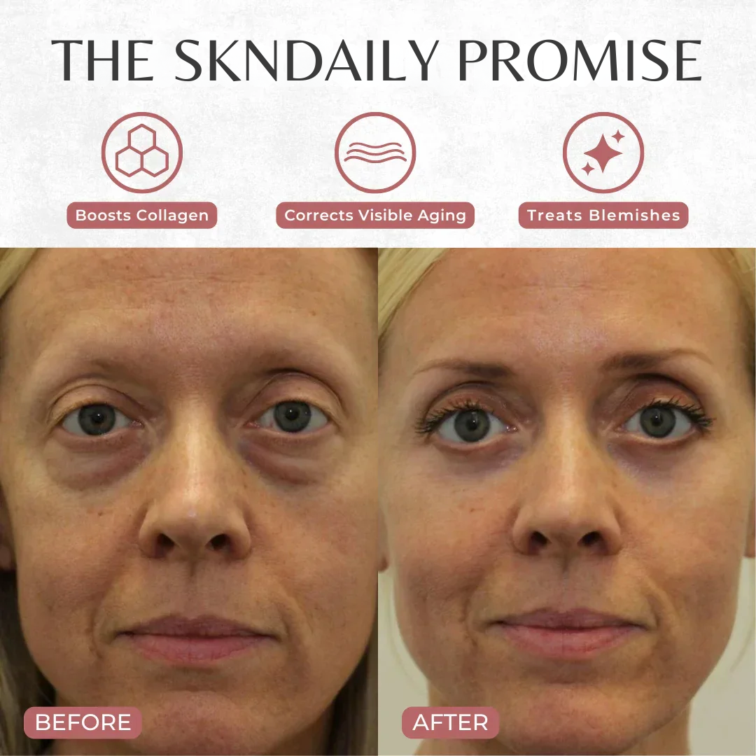 SKNDAILY™ – REVIVE NECK & DÉCOLLETÉ CREAM