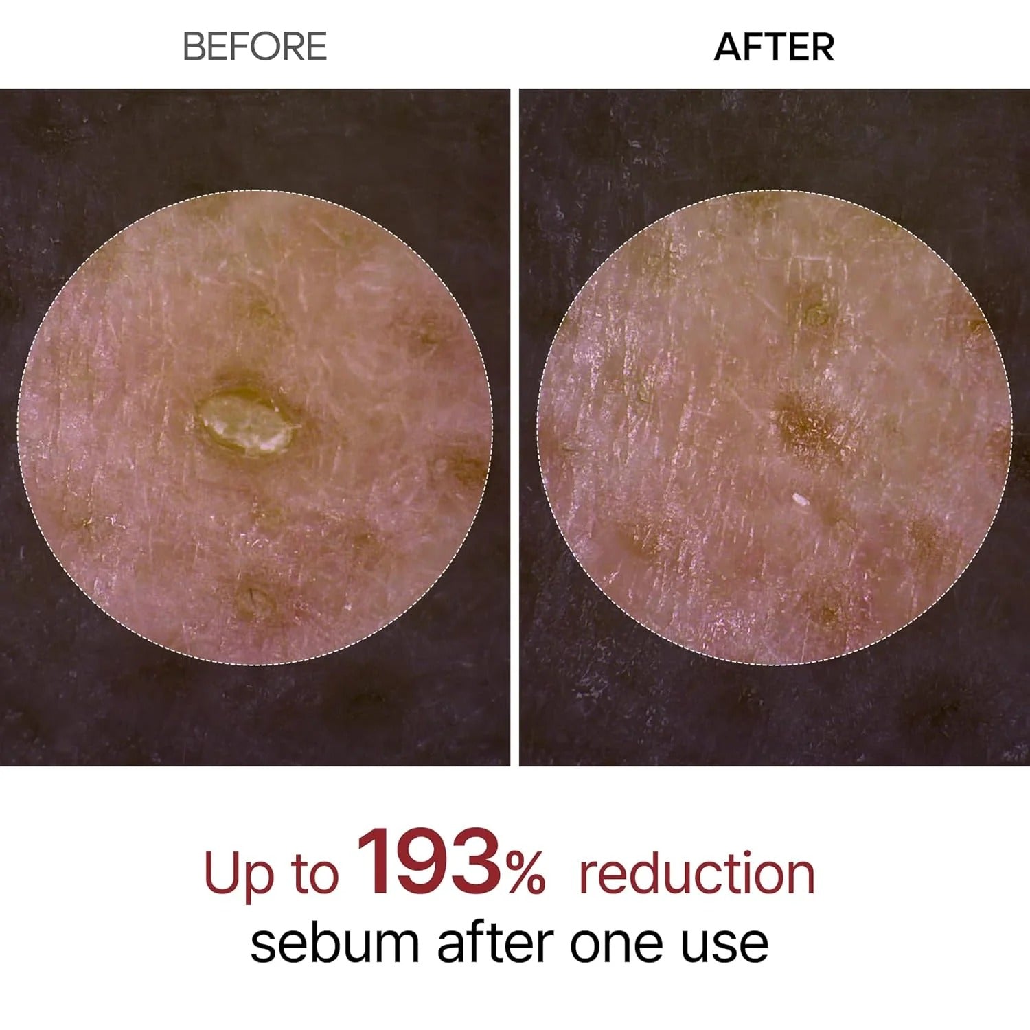 SKNDAILY™ - RADIANT GLOW RICE PEELING