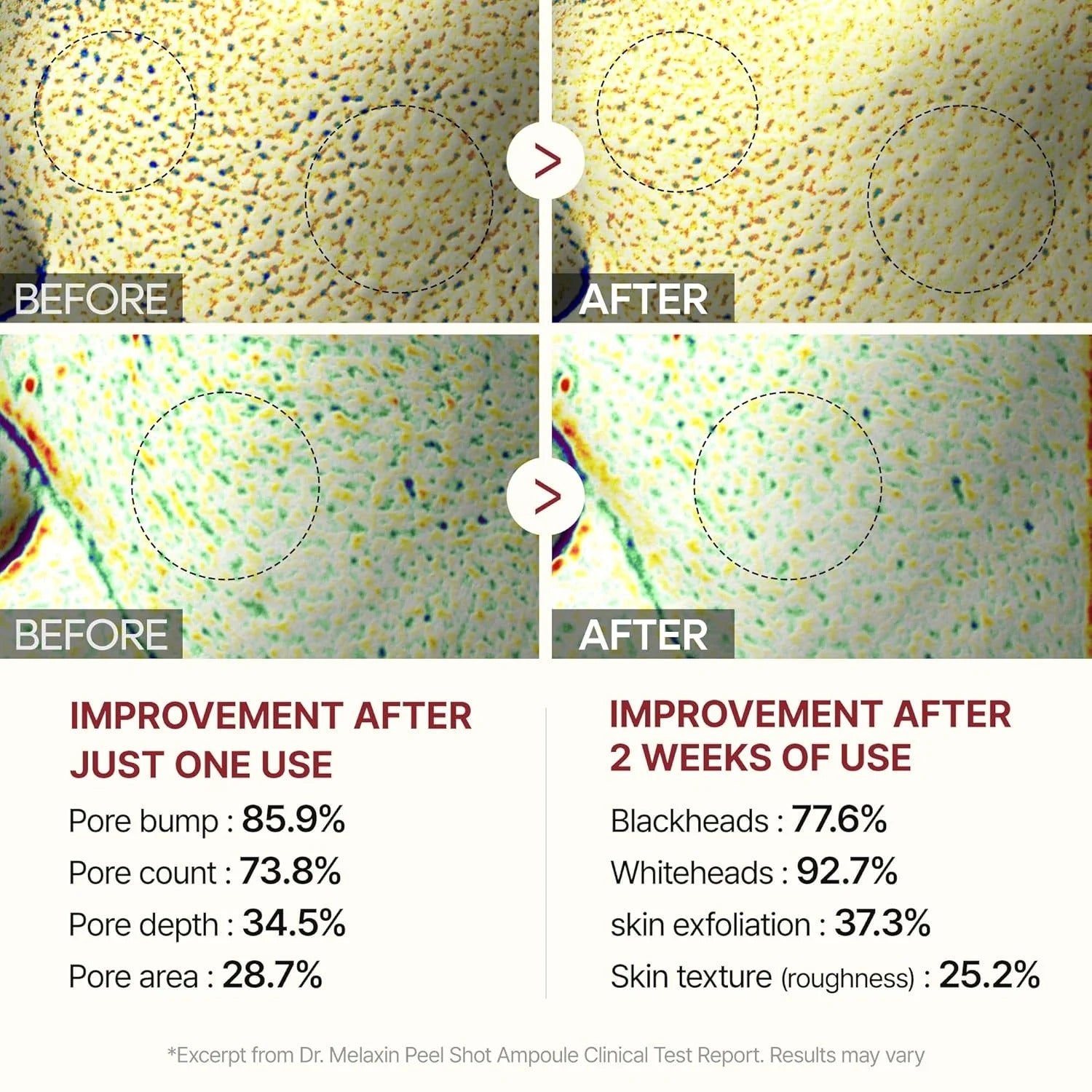 SKNDAILY™ - RADIANT GLOW RICE PEELING