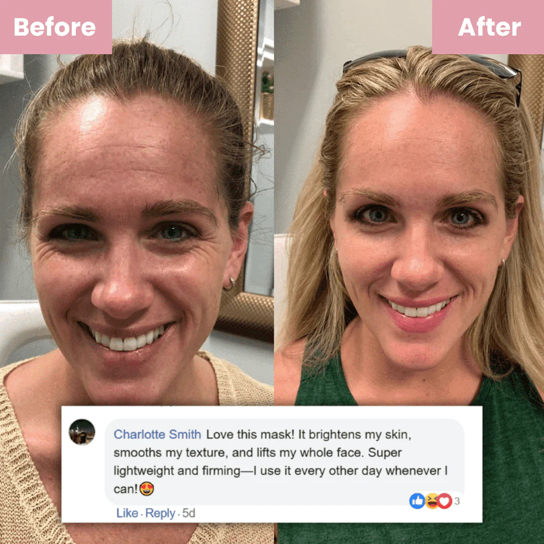 MEDICUBE™ — COLLAGEN LIFT MASK