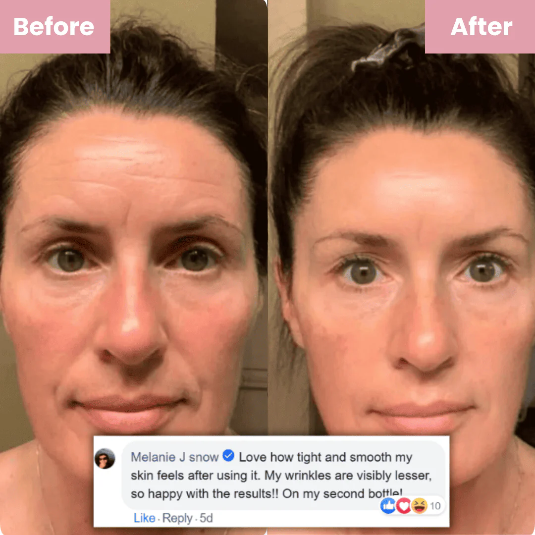MEDICUBE™ — COLLAGEN LIFT MASK